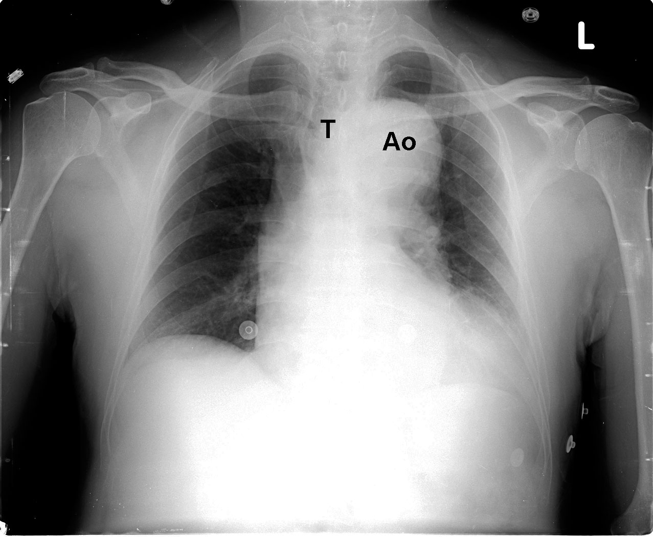 Mastermedfacts Chest X Ray